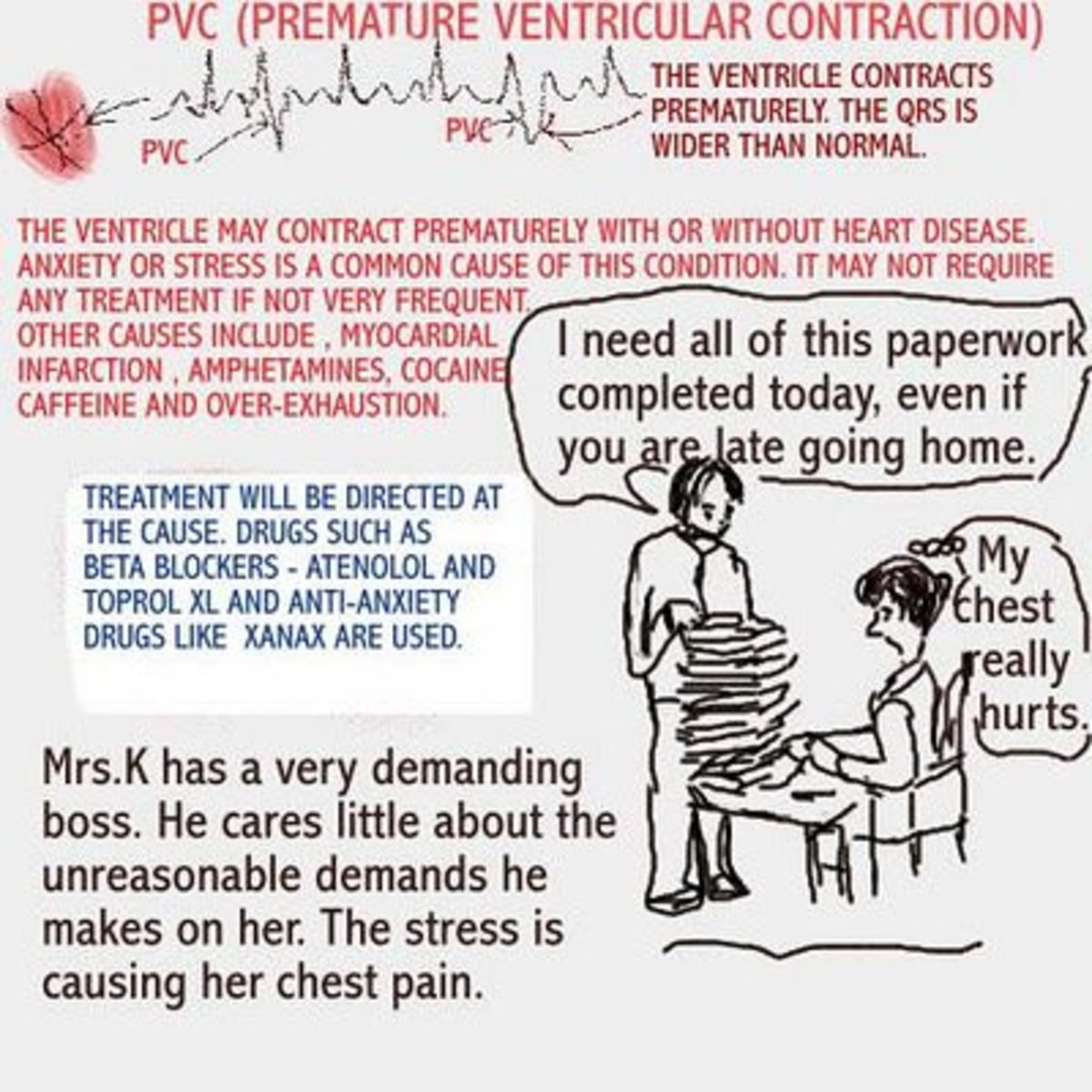 cardiac-arrhythmias-premature-ventricular-contraction-the-skipped-beat