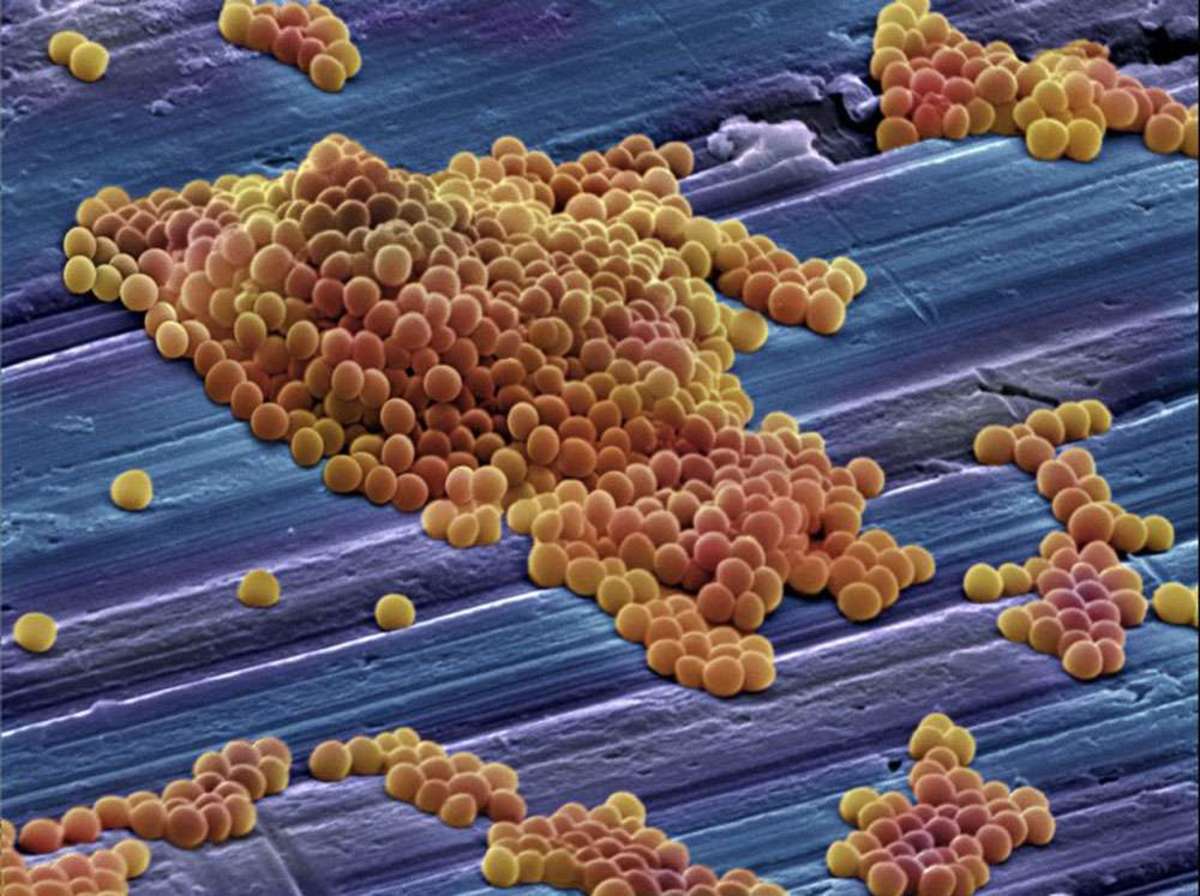 MRSA bacteria