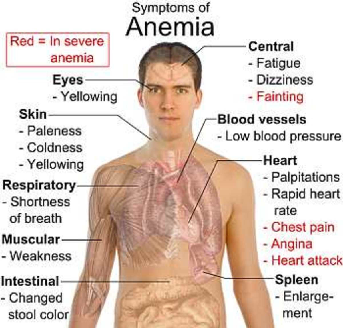 Symptoms of Anaemia 