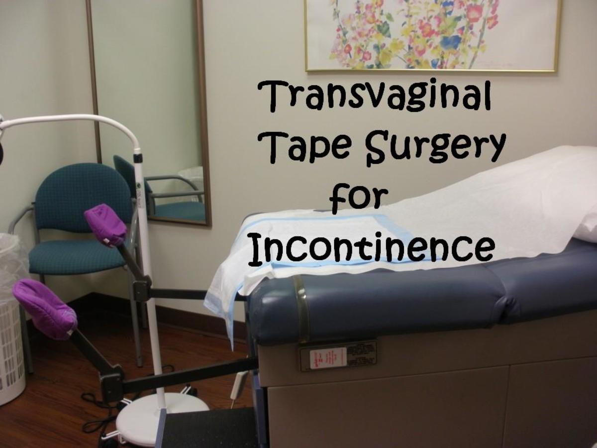 My Experience with TVT - Transvaginal Tape Surgery for Incontinence