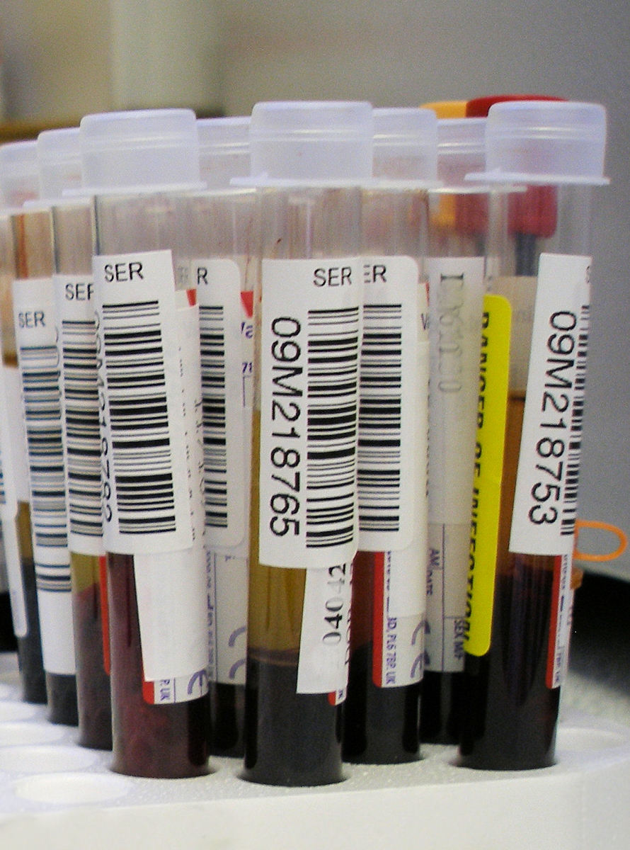 Vials of human blood samples.