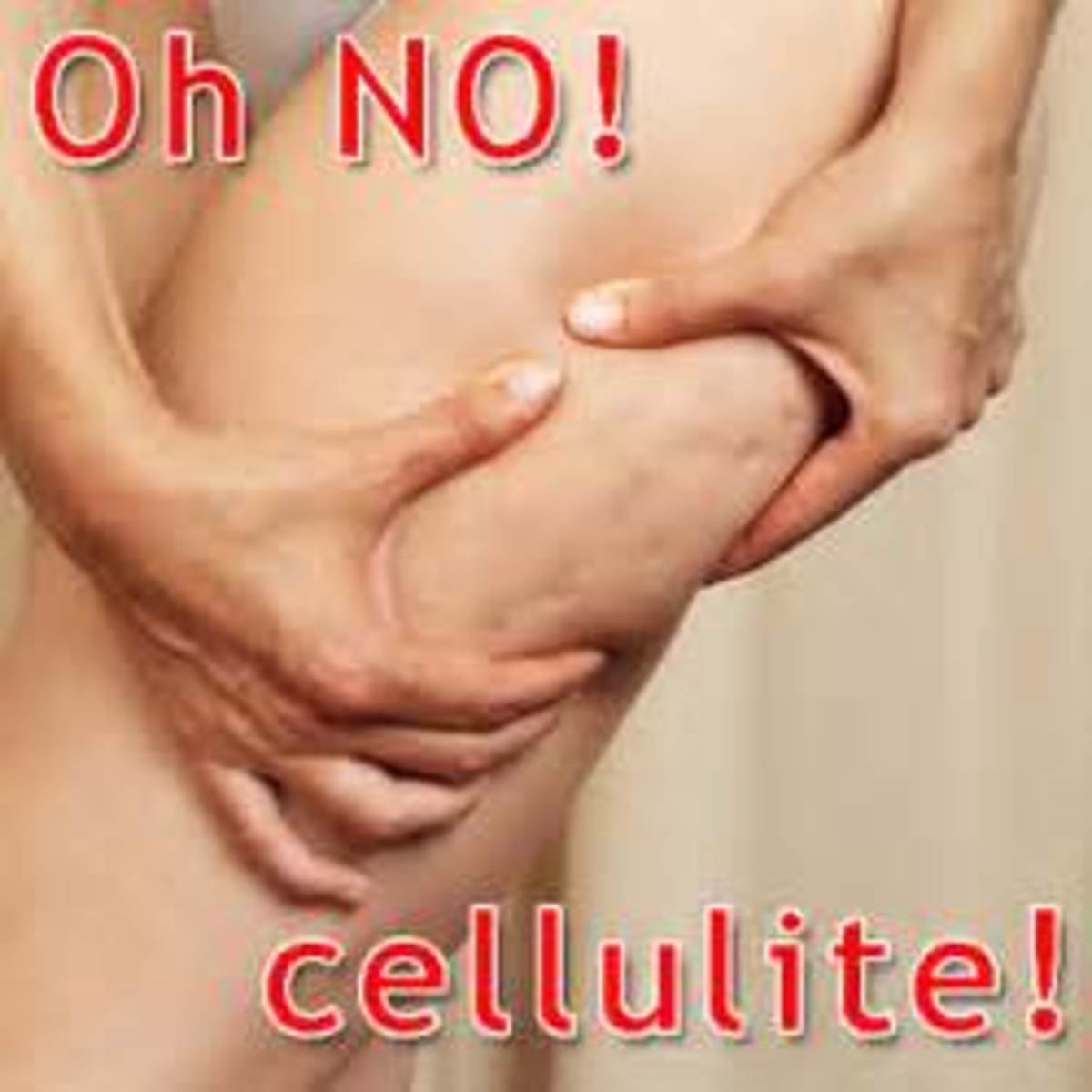 Popular myths on Cellulite: Fighting the cottage cheese