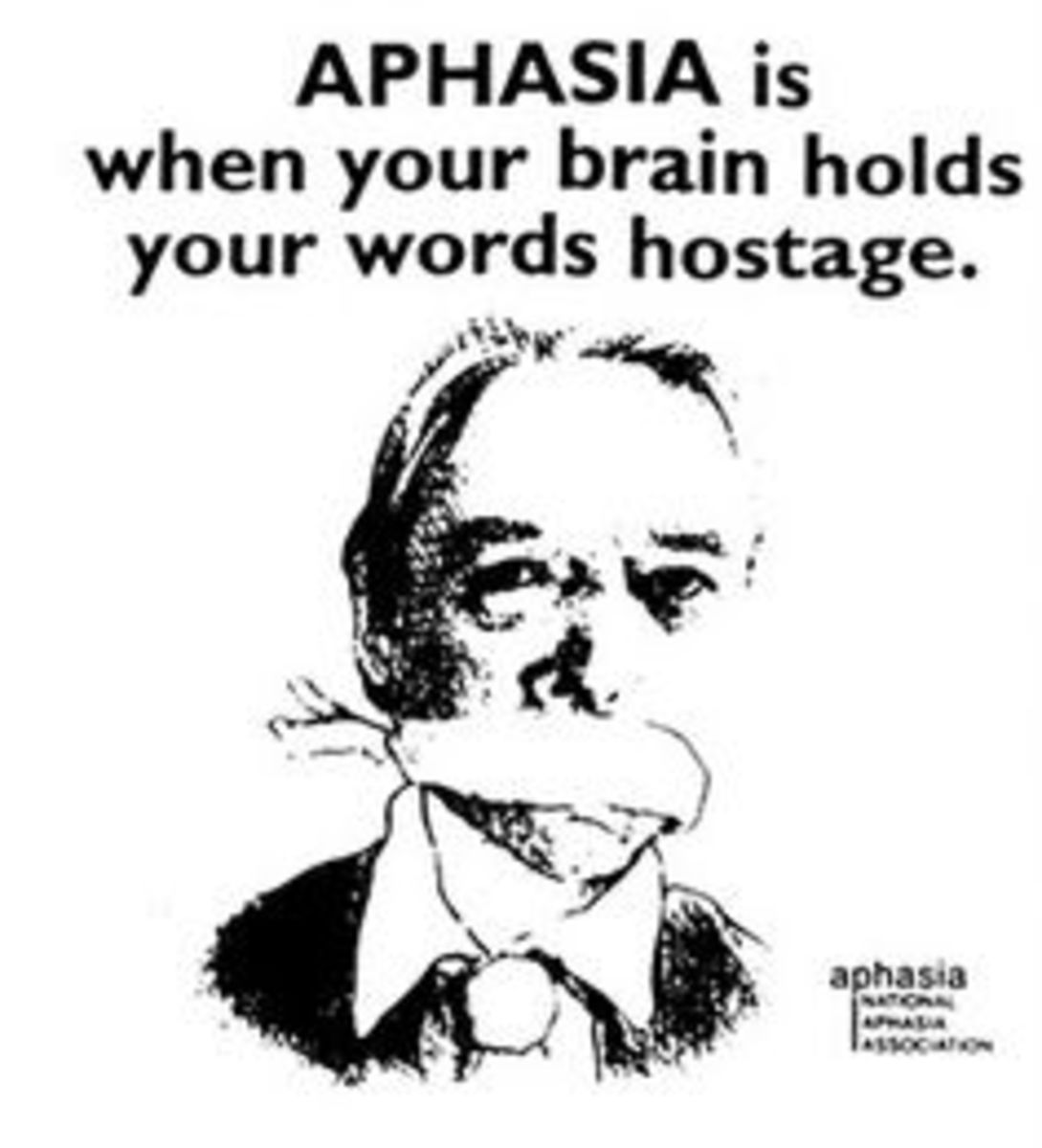 At a Loss for Words: Aphasia