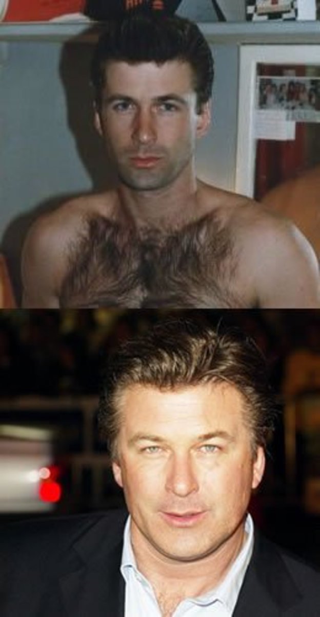 The Baldwin Brothers Hubpages