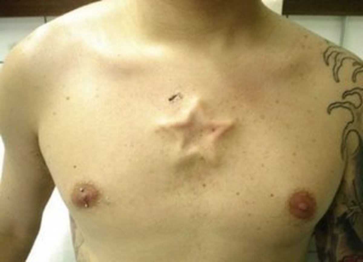 the-most-extreme-body-modification