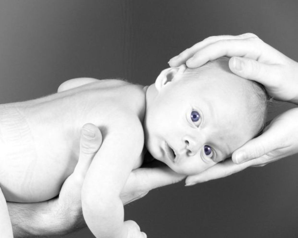 babies-born-without-eyes-surviving-birth-defects
