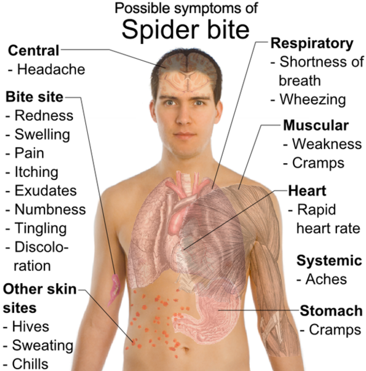 If you suspect you have been bitten by a Black Widow or another type of poisonous spider seek medical help as soon as possible.