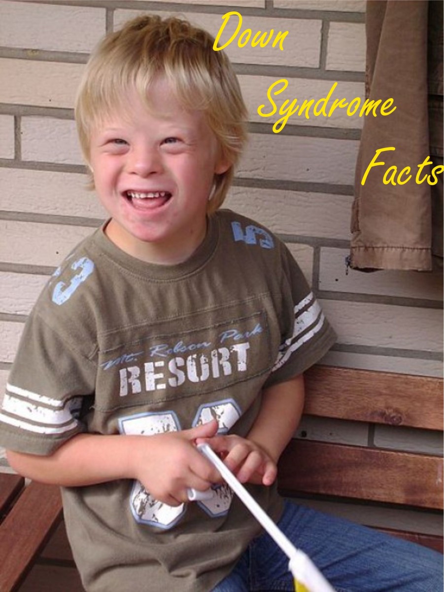 What Is Down Syndrome: Facts and Symptoms