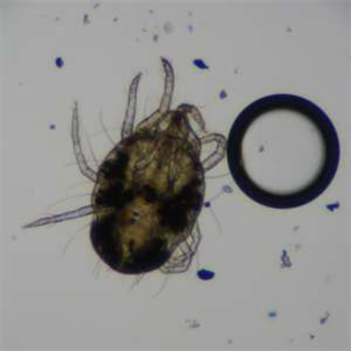 Dustmites can be found all over our homes, They are very small and hide in our bedding, carpets, sofas, etc.