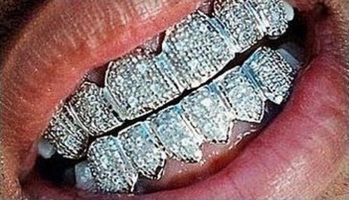 What the Heck are Dental Grillz? HubPages