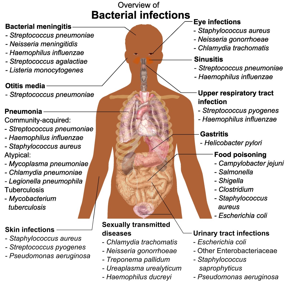 Bacterial infections that can be treated by Enhancin