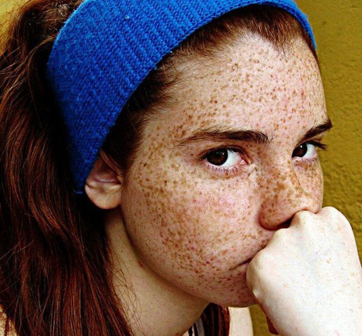 my-flawless-skin-thanks-to-obagi-the-best-for-removal-freckles
