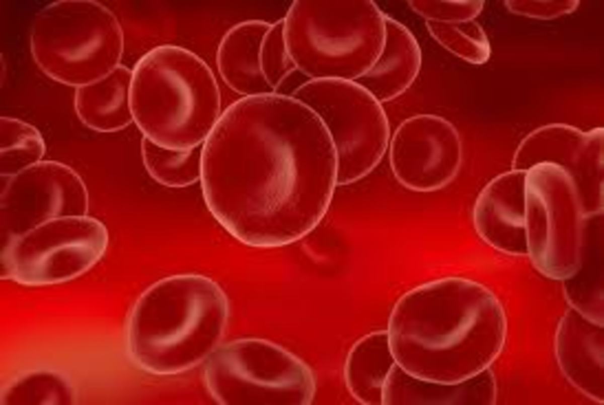 Blood Transfusion for Prostate Cancer