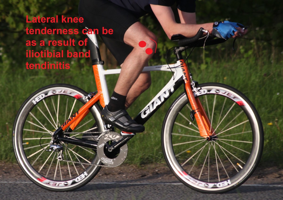 Cycling Knee Pain Causes, Symptoms and Treatment HubPages