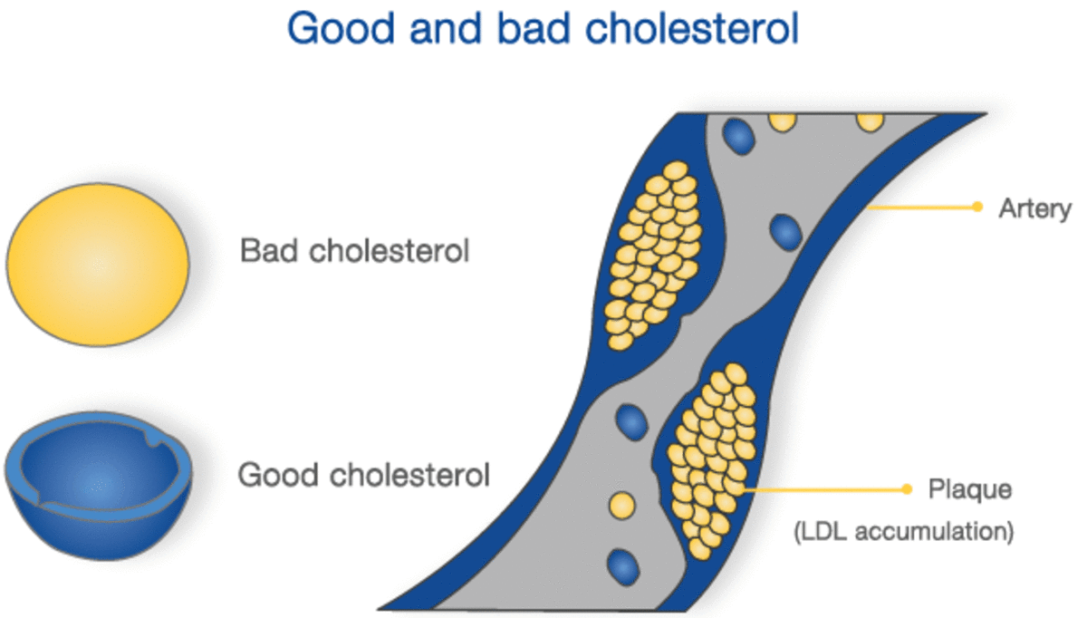 cholesterol-the-product-of-our-lifestyle