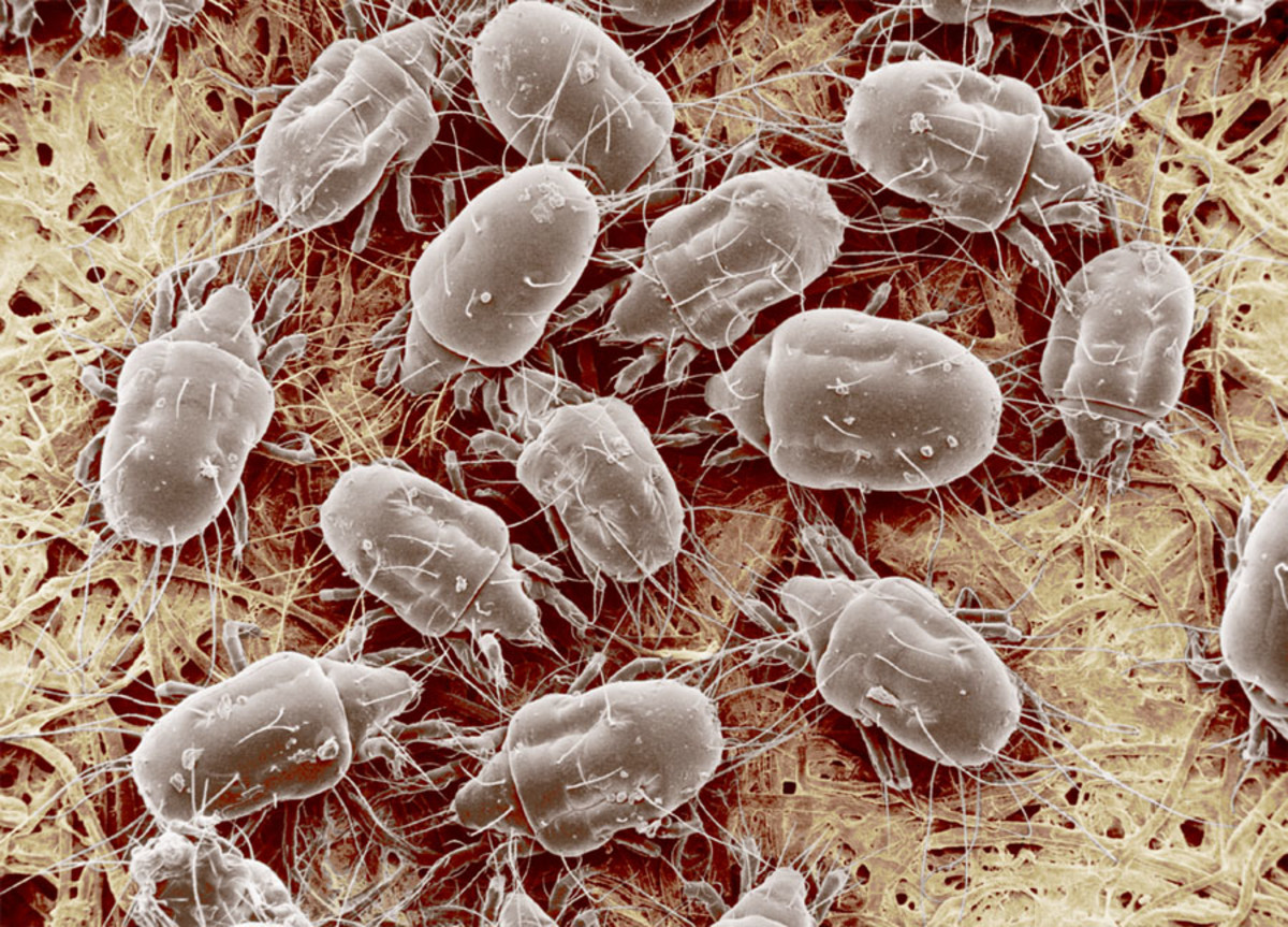 how-to-treat-your-home-against-dust-mite-allergy-symptoms