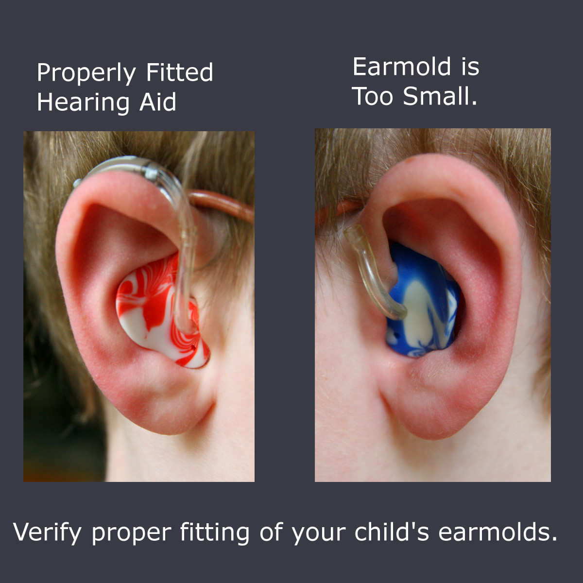 Make sure your child's hearing aids fit properly. The earmold on the left is properly fitted - the one on the right is too small and leaves a gap.
