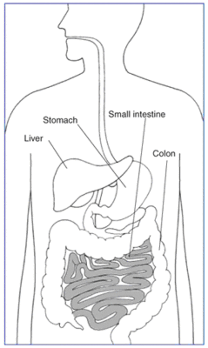Diagram of the biology of Celiac Disease