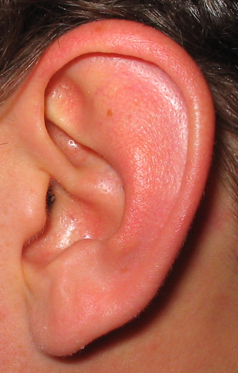 How to Identify and Treat a Child's Ear Infection