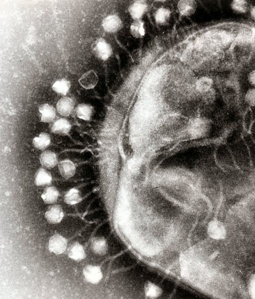 An electron micrograph of a swarm of bacteriophage particles.