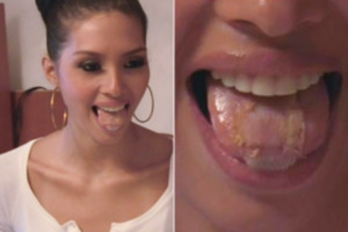 Miss Venezuela 2013 First Runner Up Wi May Nava with her tongue patch.