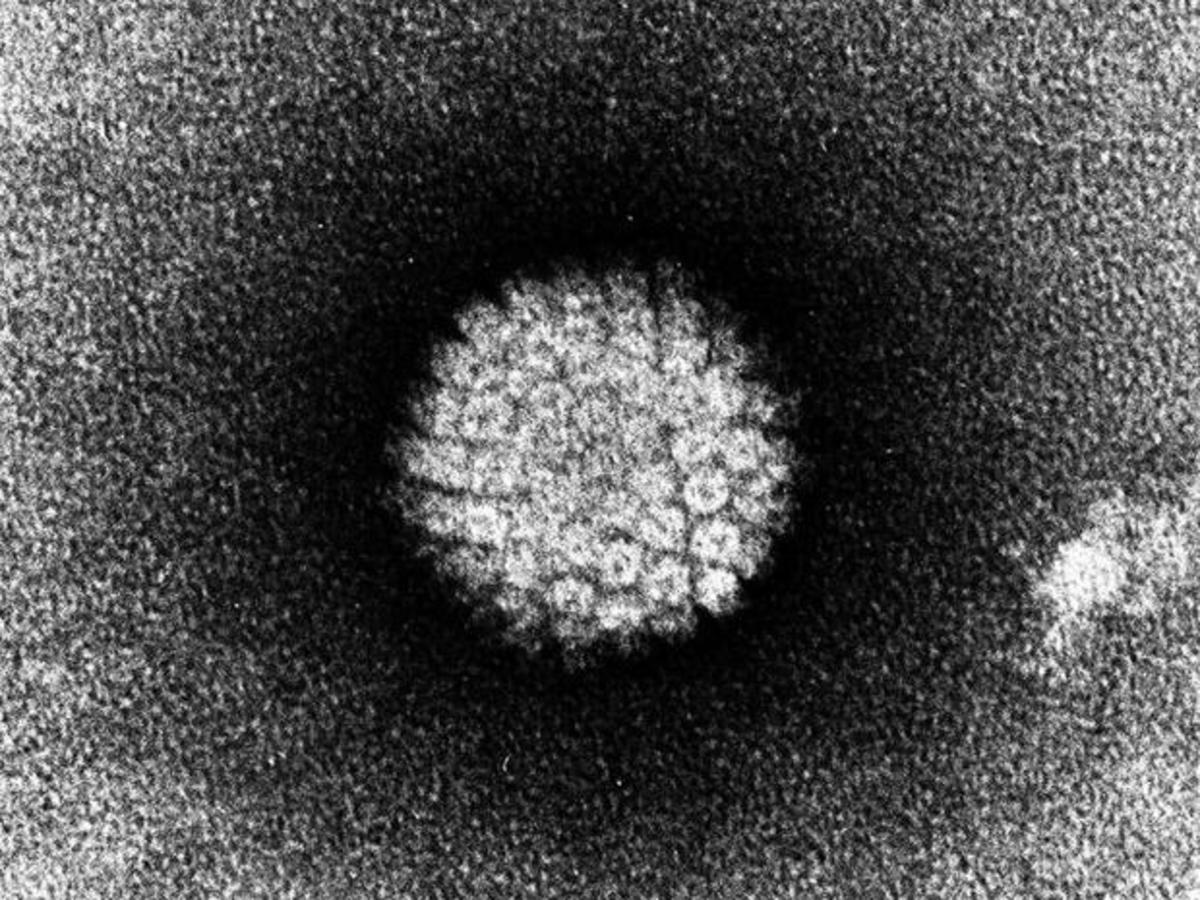 HPV under electron microscope!
