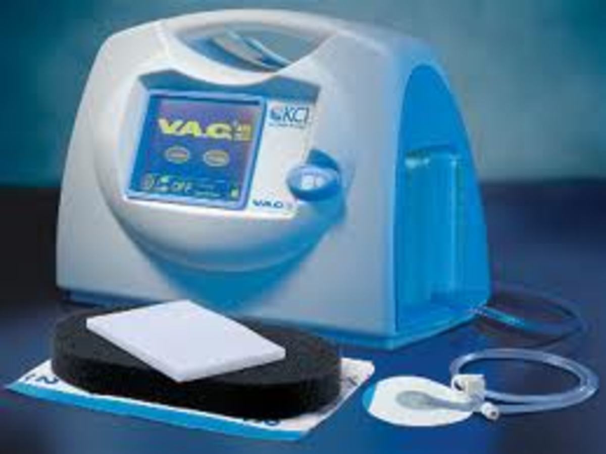Wound Vac Therapy Information, Pictures and Cost