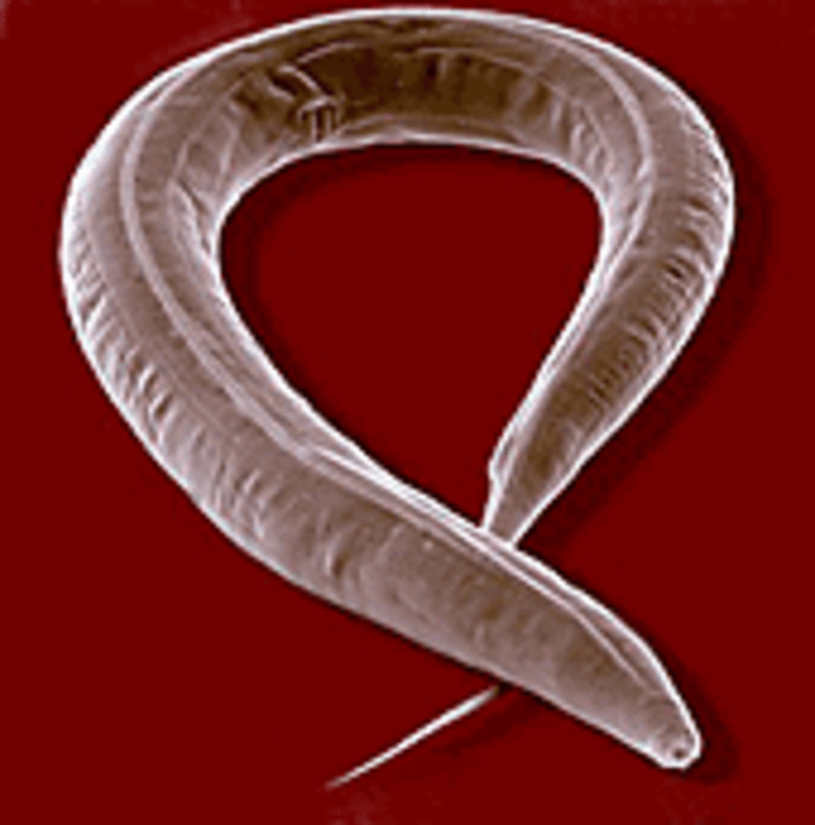 Roundworms are not earthworms either!