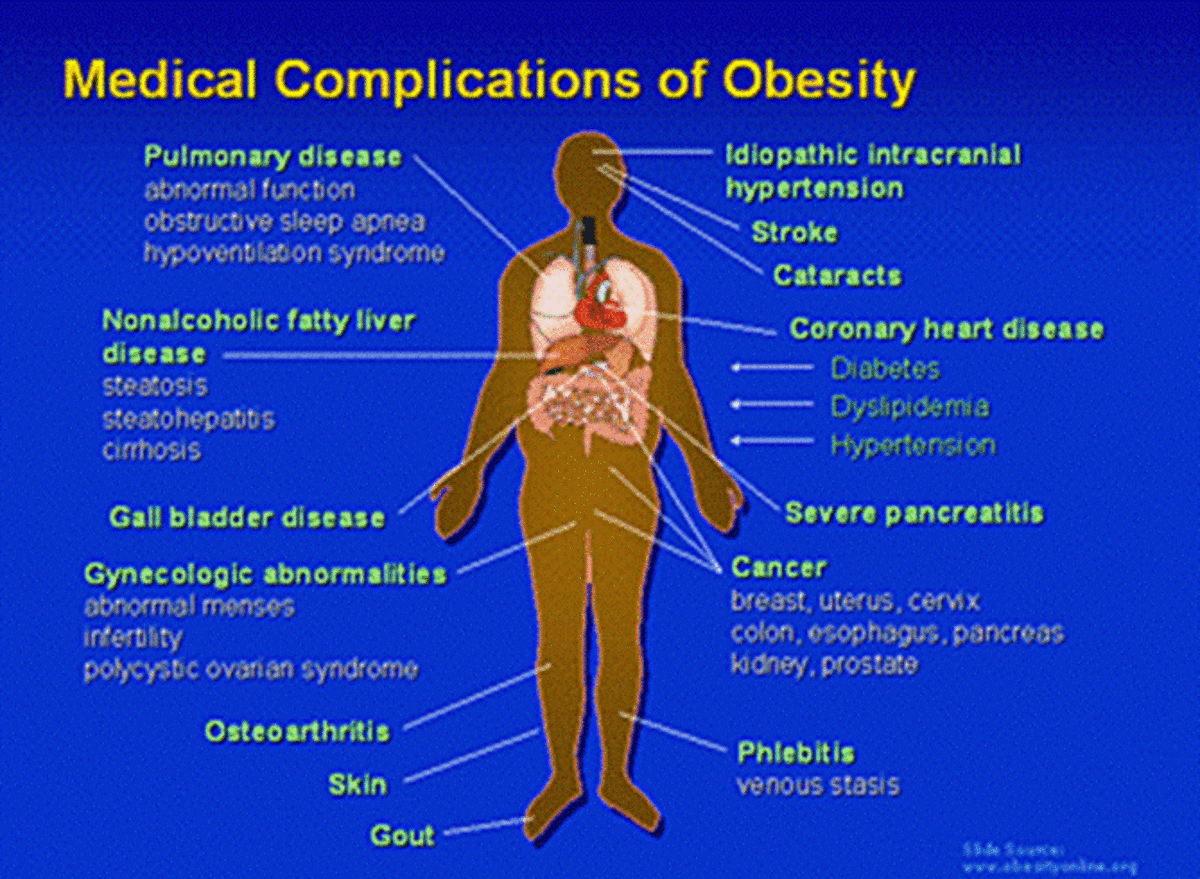 Obese people come to the doctor not only complain about their fitness but also with complications (cardiovascular, pulmonary, orthopedic and others).