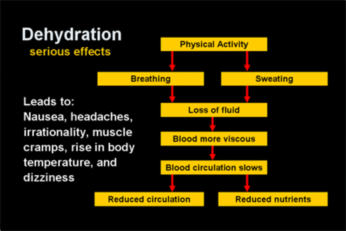 Signs of dehydration 