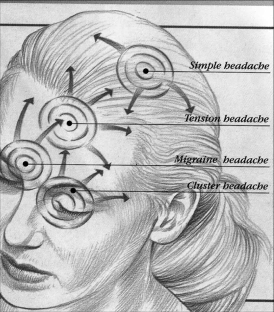 Headaches-Stress-Tension Headaches-Relief For Headaches- head-back- types- causes