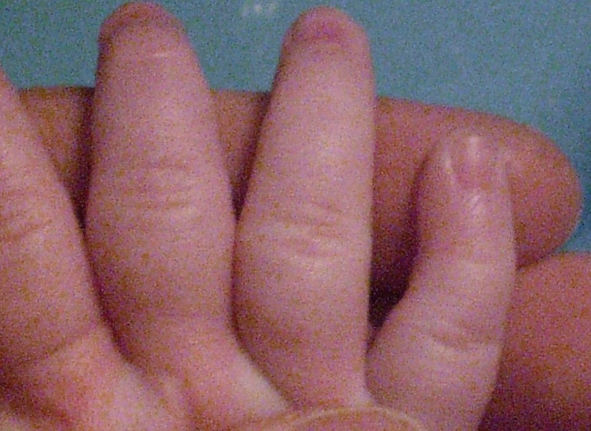My five-month-old daughter's pinky.