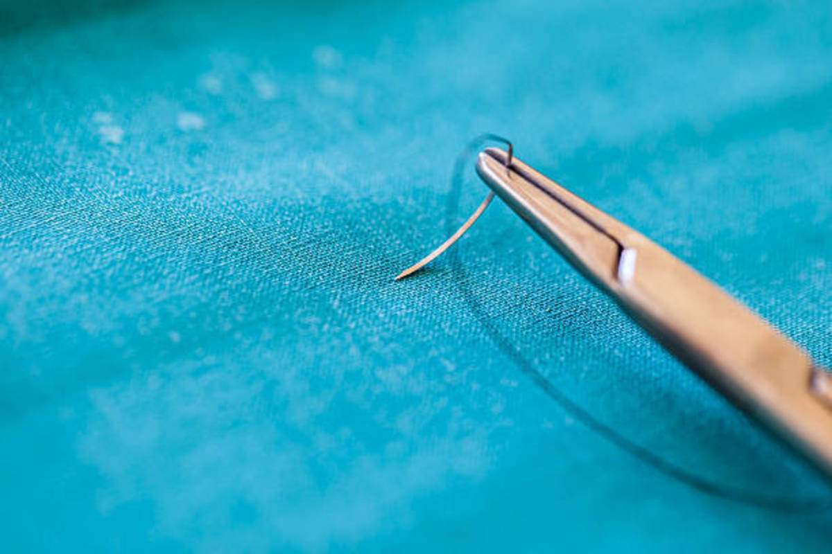 how-to-suture-the-bleeding-heart
