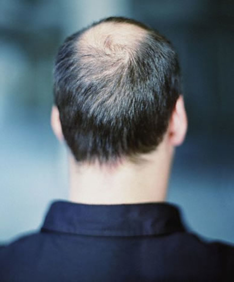 Natural Ways of Preventing Hair Loss and Growing Thicker Hair