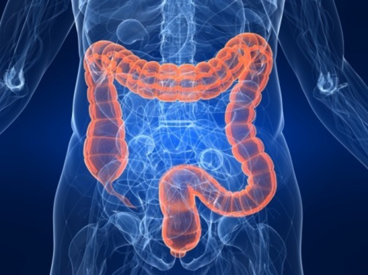 How Colonoscopies Reduce the Risk of Colon Cancer
