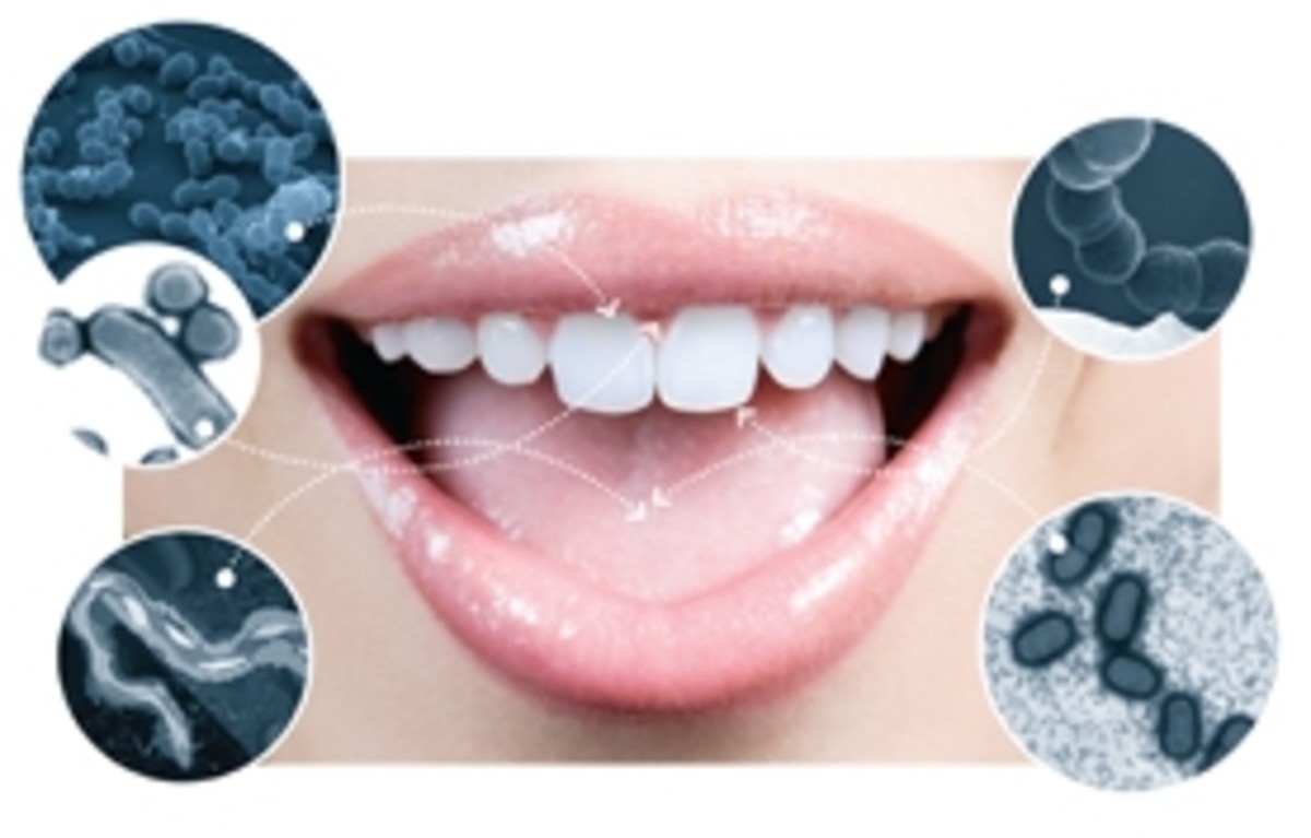 halitosis-oral-malodour-teeth
