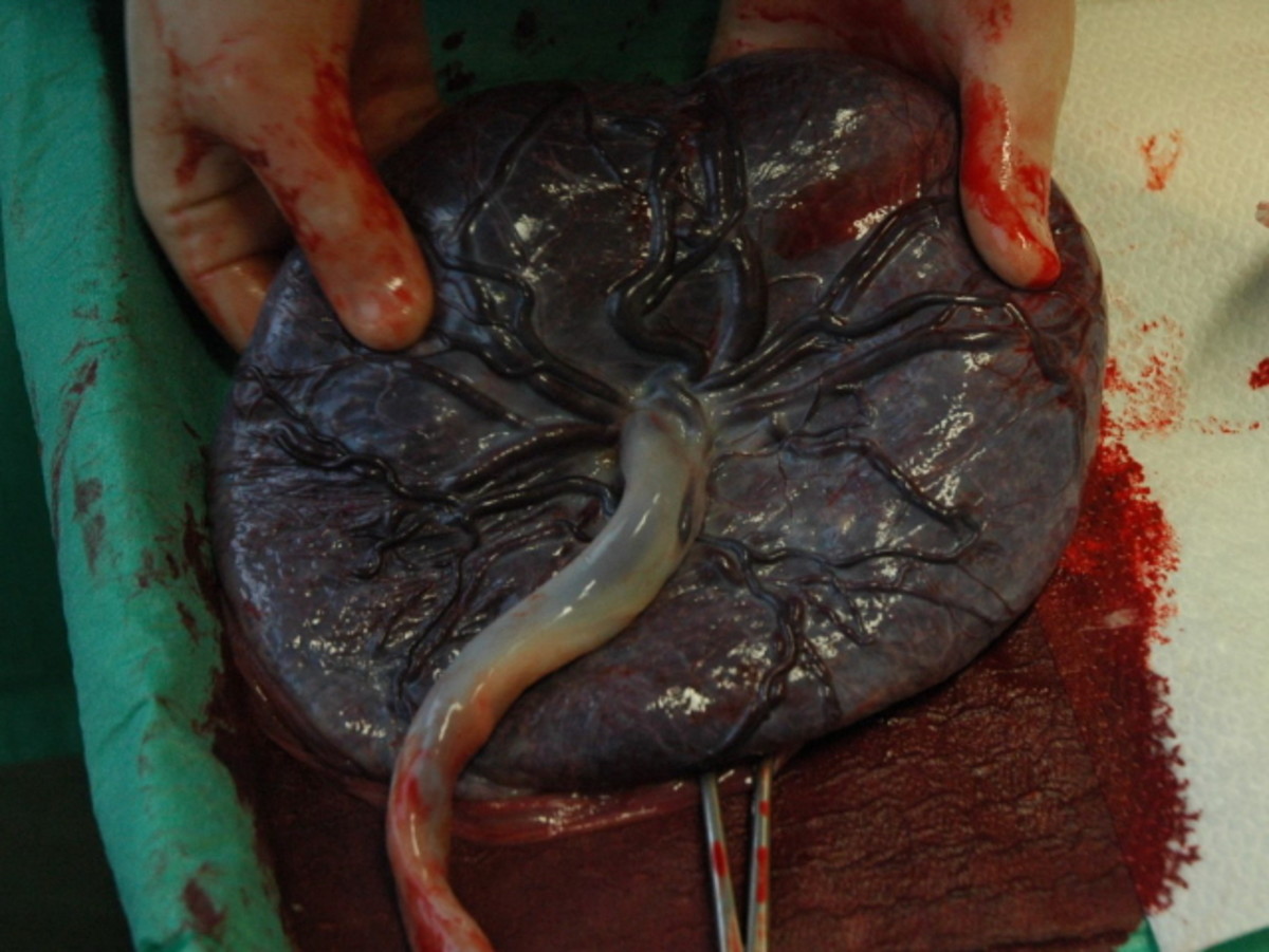 human placenta 