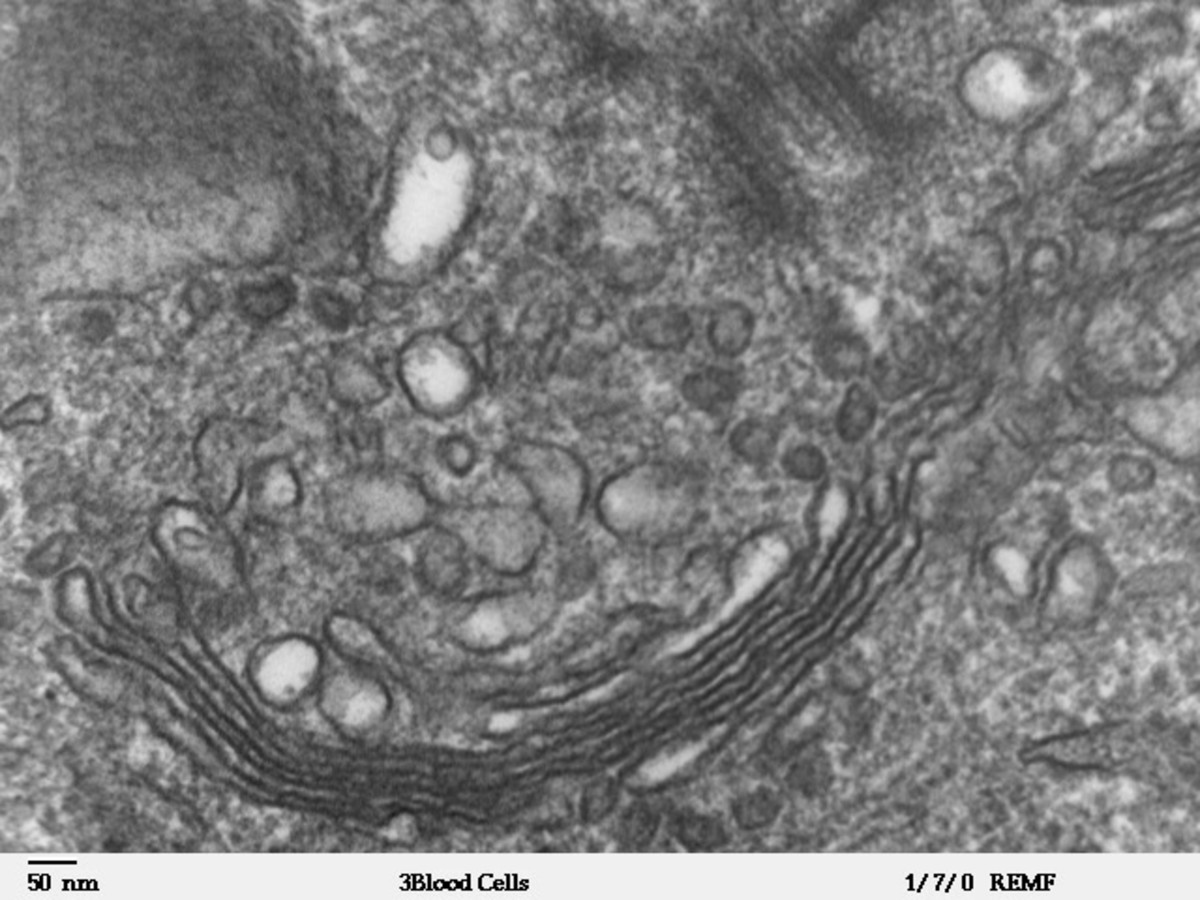 The Golgi is the post office of the cell and looks like a series of flattened sacs, getting smaller towards the outside of the cell. You will often see vesicles budding off the Golgi.