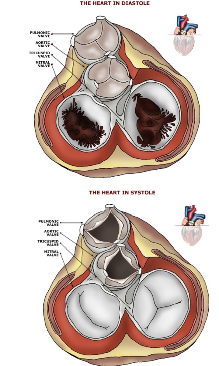 The Four Heart Valves. Mitral and Tricuspid valves and the aortic and Pulmonic Valves