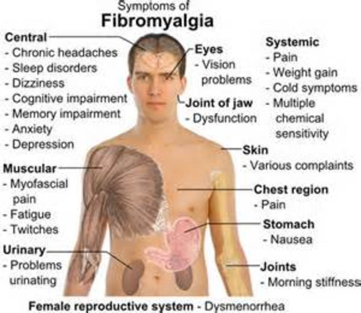 what-to-do-about-fibromyalgia