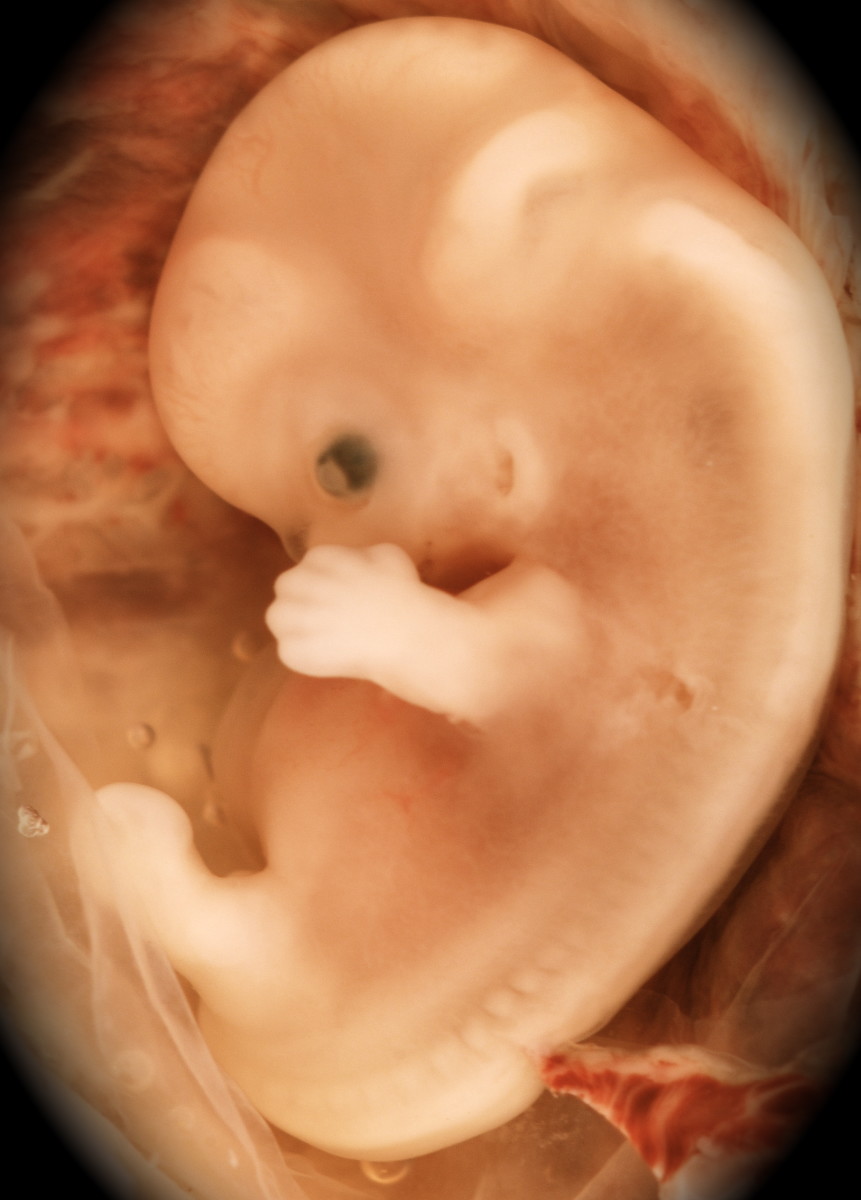At the ninth week of development the baby has eyes, ears, mouth, spinal cord, brain, heart, vital organs, limbs, fingers and toes. 