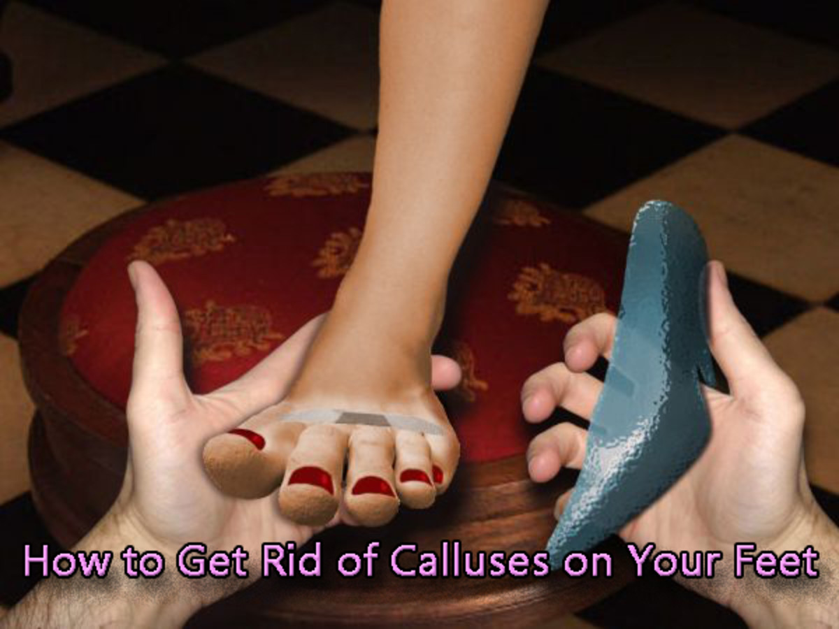Get rid of those hideous calluses on your feet almost effortlessly and completely painless. 