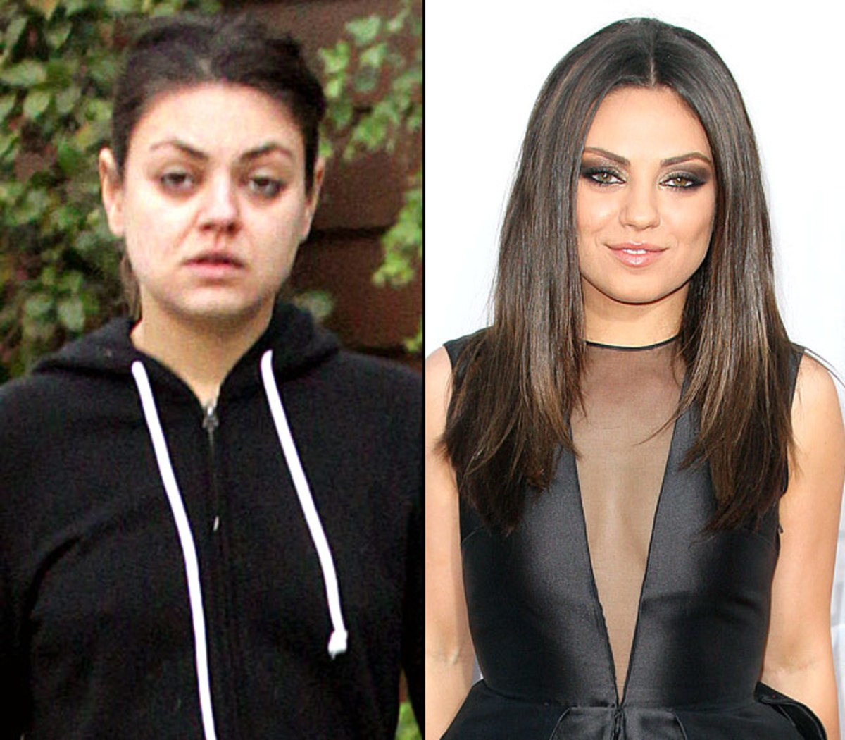 Celeb with dark circle