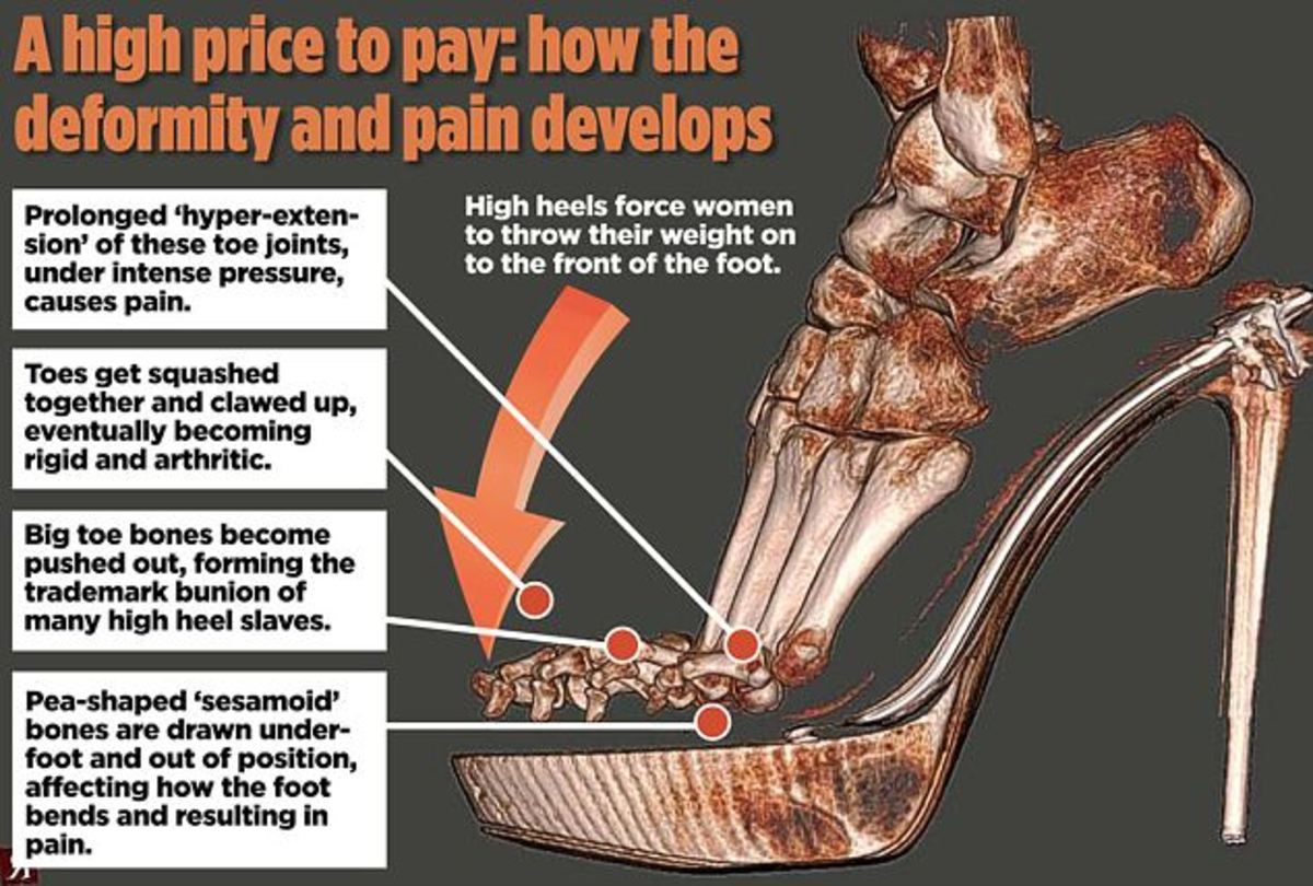plantar-fascia-foot-pain-symptoms-causes-and-treatment