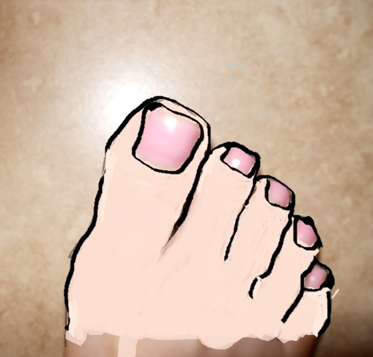 Big Toe Pain With a Surprising Diagnosis (and Easy Fix)