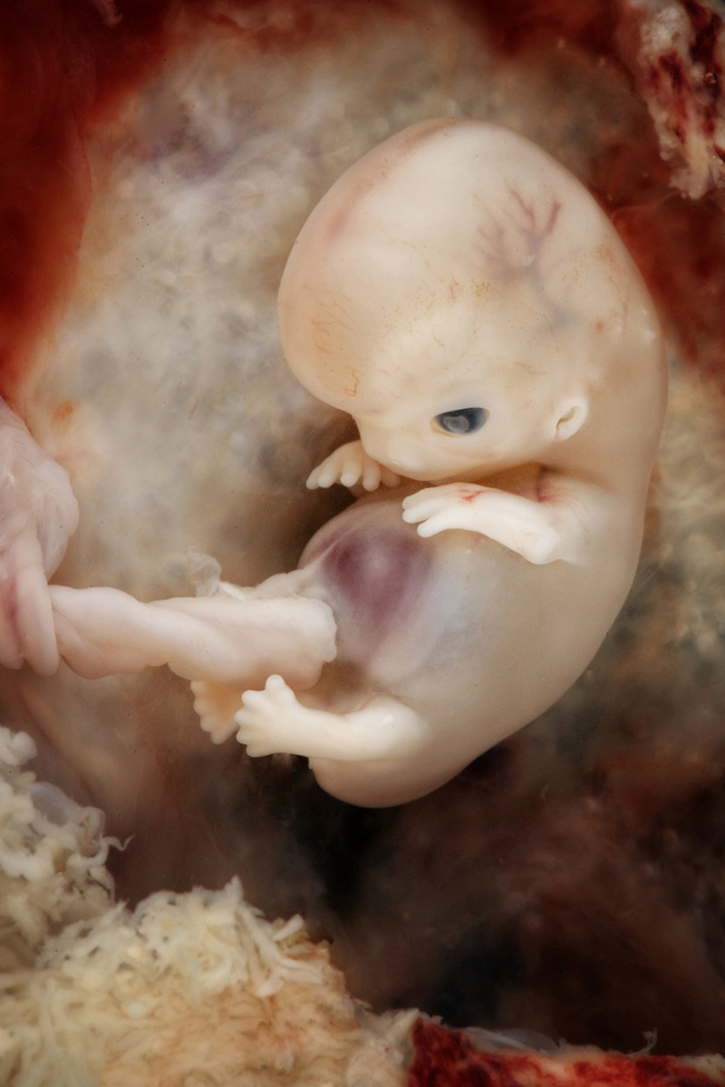 Embryo 7 -8 Weeks - Photo