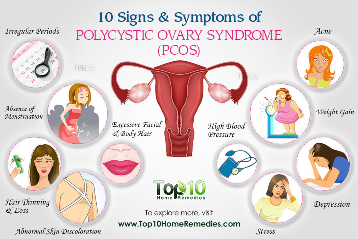 Summary of PCOS Symptoms