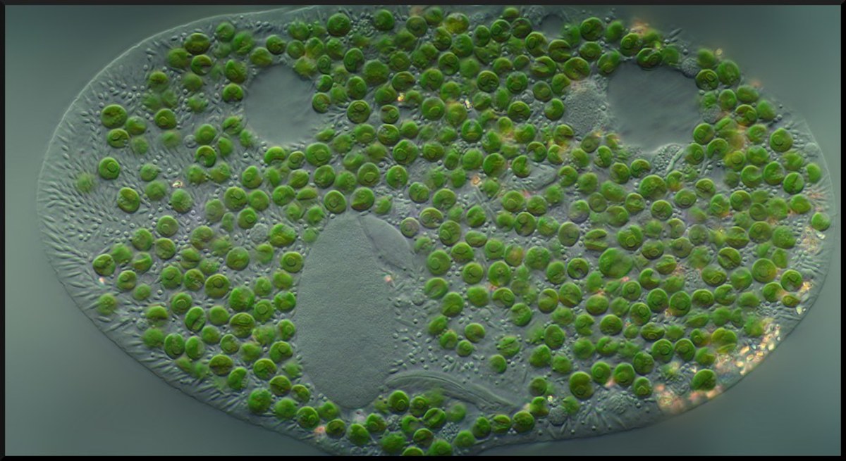 The ciliate Paramecium bursaria with endosymbiotic algae