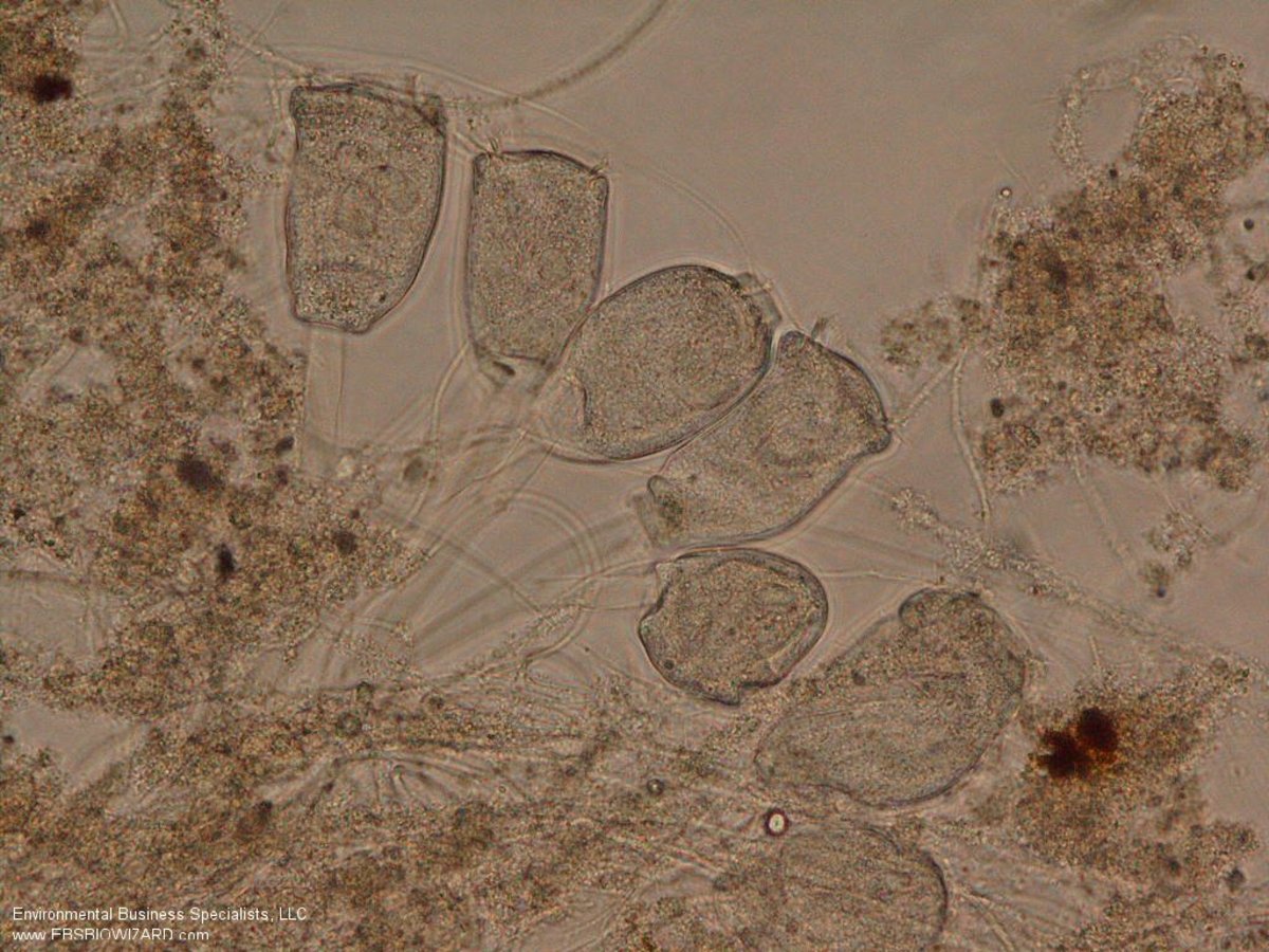 Ciliates found in wastewater include stalked species such as Epistylis, which feed on bacteria in the water