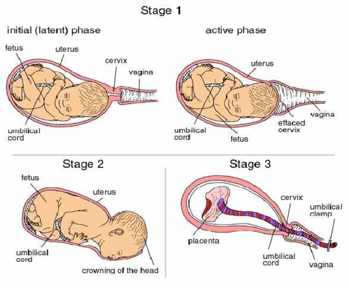 Stages Of Labor HubPages